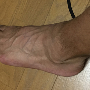 HOKA クリフトン２